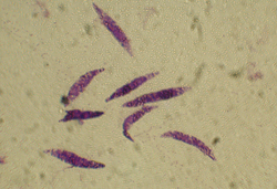 Wasting Disease pathogen Labyrinthula zosterae photo credit see below**